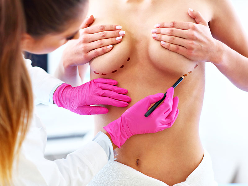 Breast Reduction - Medical Tourism Turkey