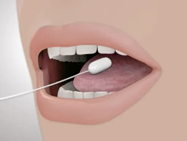 Swallowable-Gastric-Balloon​