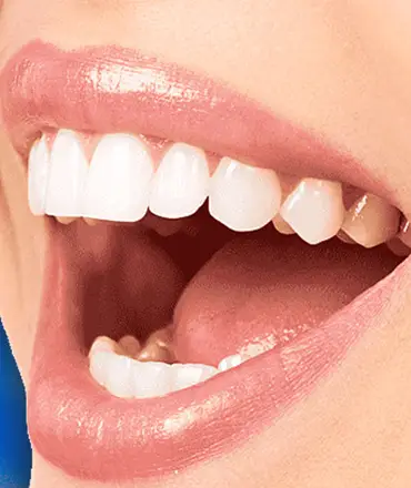 Dental Treatments - Medical Tourism Turkey