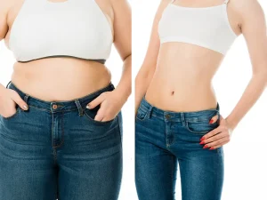 Before & After - Medical Tourism Turkey