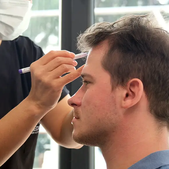 Haartransplantation - Medical Tourism Turkey