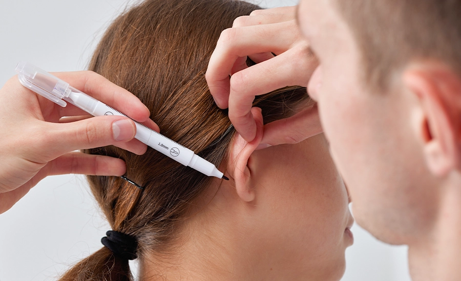 Otoplasty, Otoplasty in Antalya, Medical Tourism Turkey