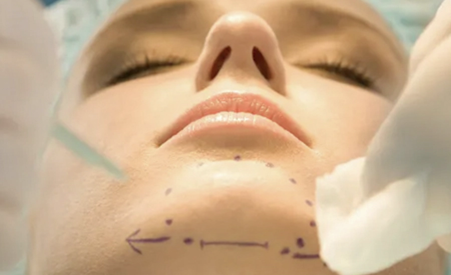 Double Chin Liposuction in Antalya, Medical Tourism Turkey, Double Chin Liposuction