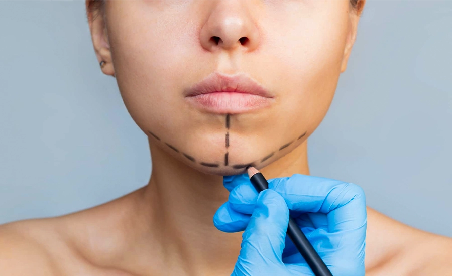 Genioplasty, Chin Surgery Medical Tourism Turkey, MTT