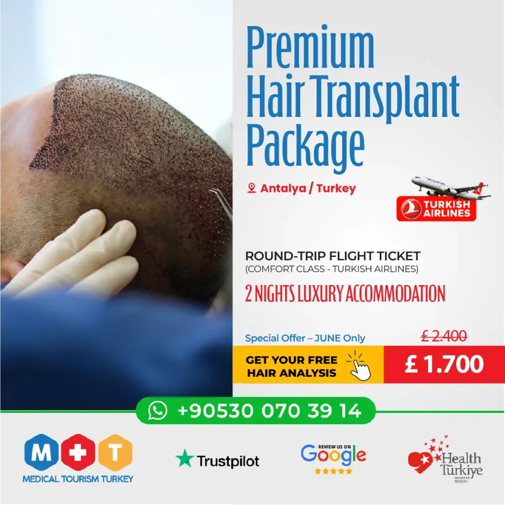 Hair Transplant Antalya