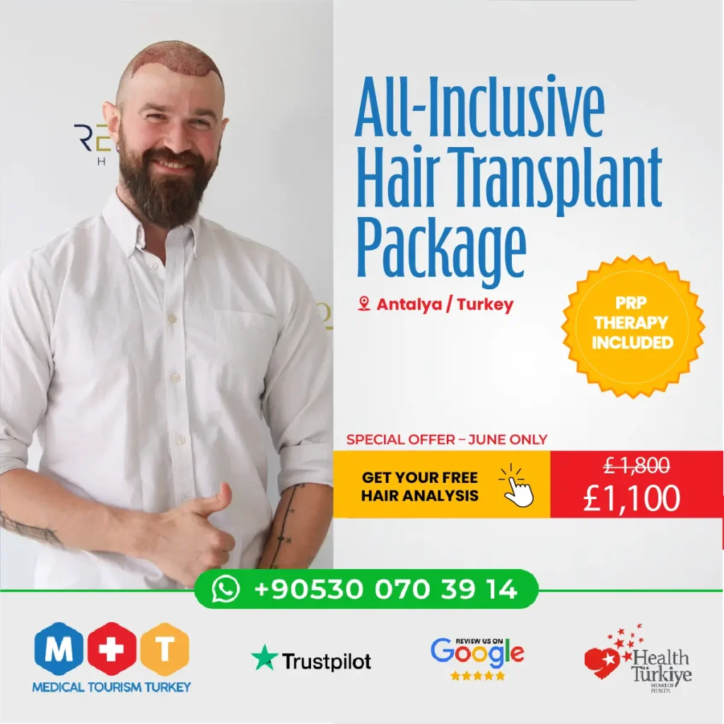 Hair Transplant Antalya