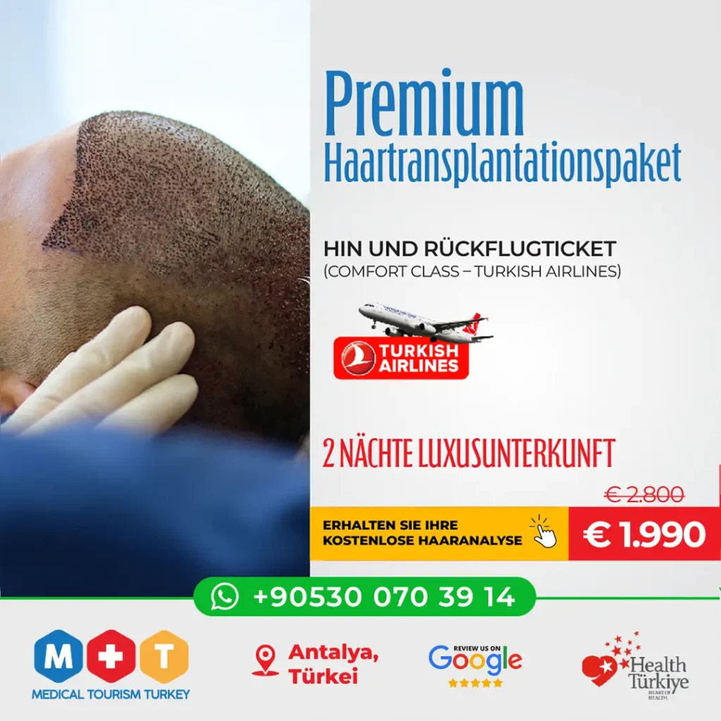 Haartransplantation in Antalya