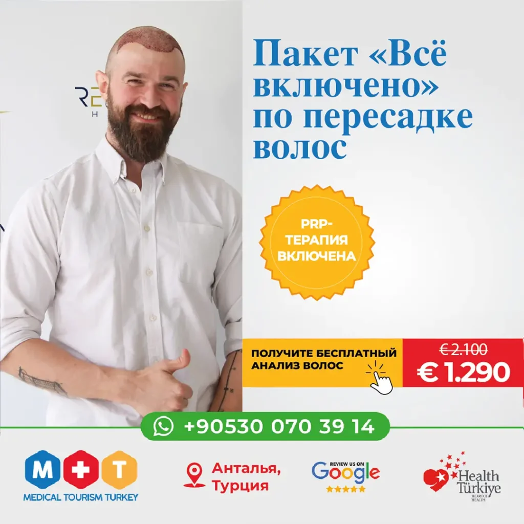 Пересадка волос в Анталии