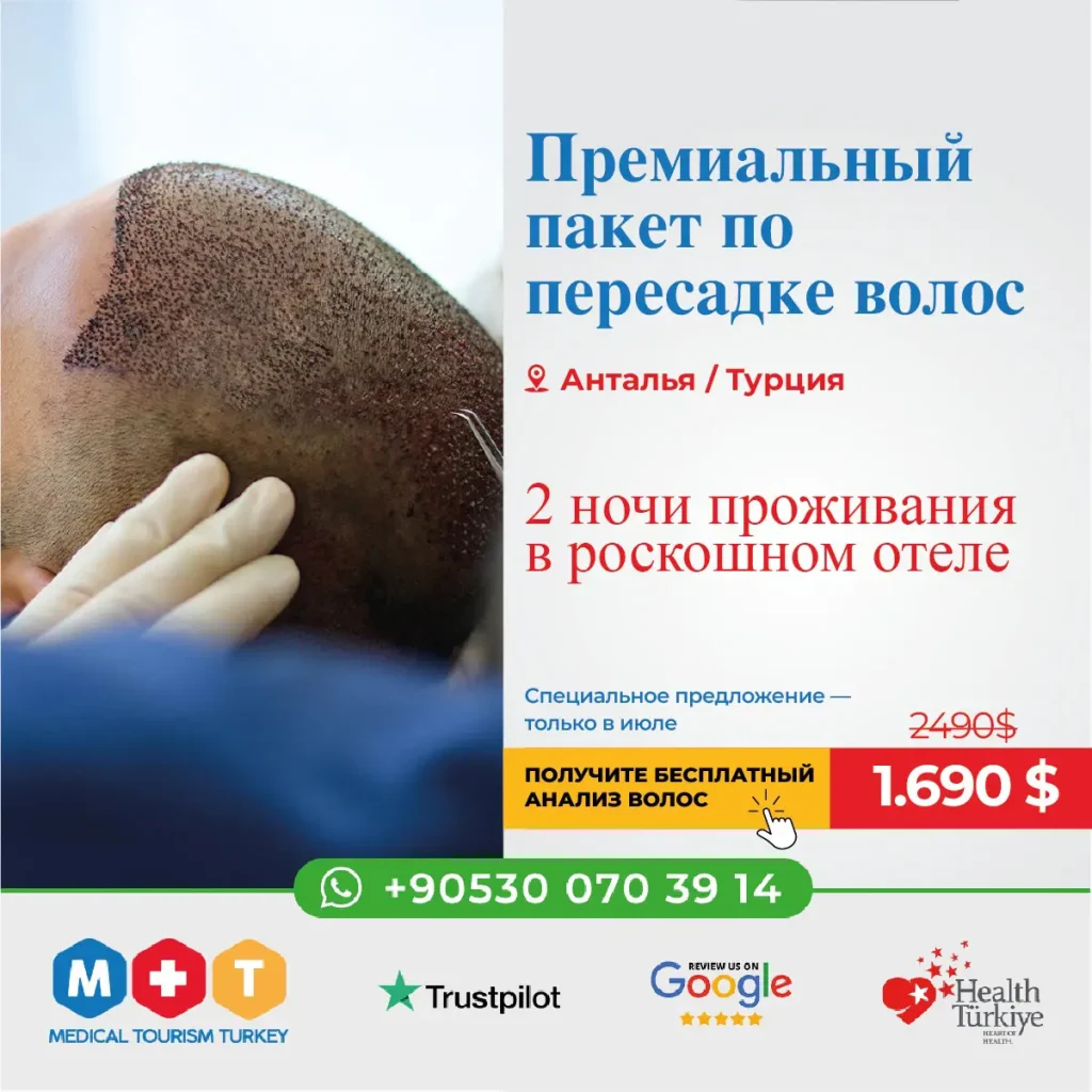 Лучшая трансплантация волос в Турции, Анталия
