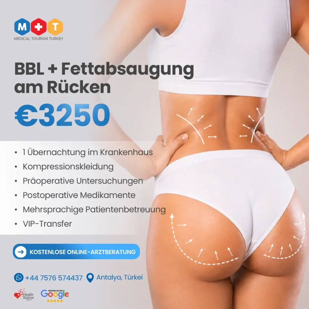 BBL + Rückenliposuktion Antalya