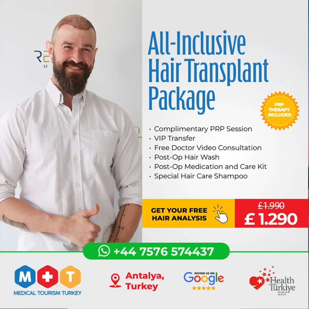 Best Hair Transplant in Turkey Antalya