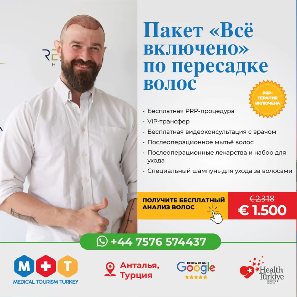 Лучшая трансплантация волос в Турции, Анталия