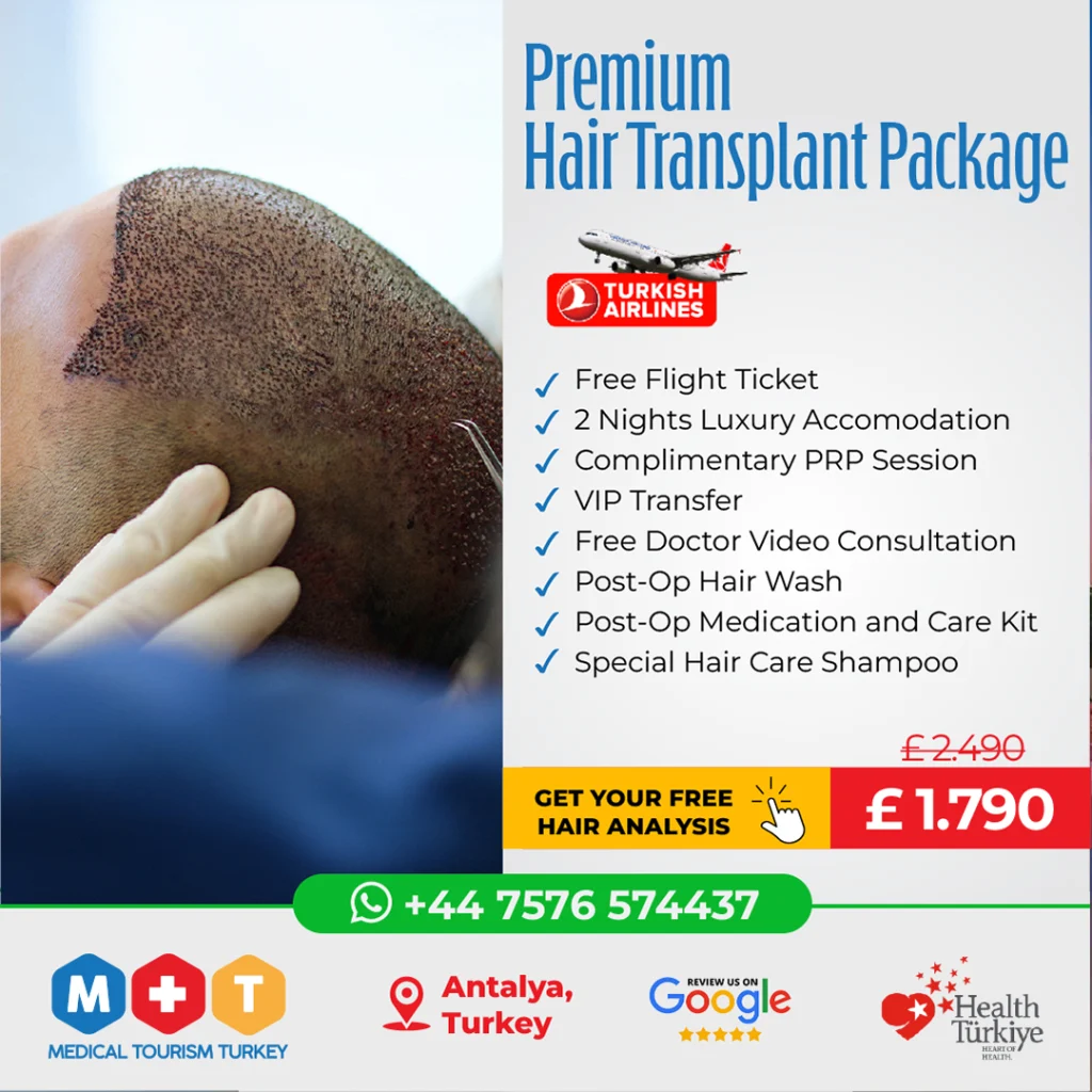 Best Hair Transplant in Turkey Antalya