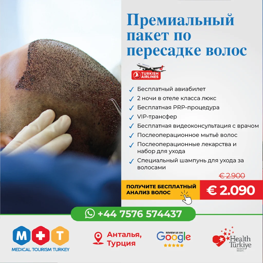 Лучшая трансплантация волос в Турции, Анталия