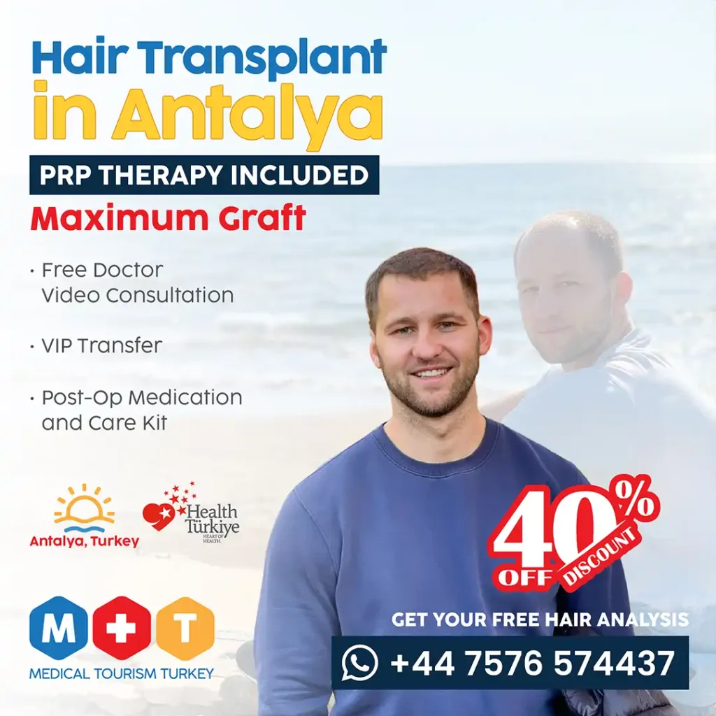 Hair Transplant in Antalya, Turkey