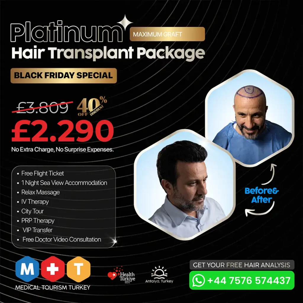 Platinum Hair Transplant in Turkey