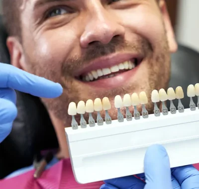 Dental Veneers – Medical Tourism Turkey Dental Veneers - Medical Tourism Turkey