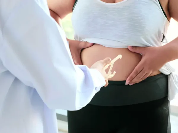 Gastric Sleeve Surgery Gastric Sleeve Surgery